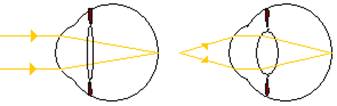 Focarul luminii unui obiect aflat la distanta si a unui obiect apropiat