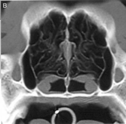 fig1b