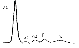 electrophorese proteine