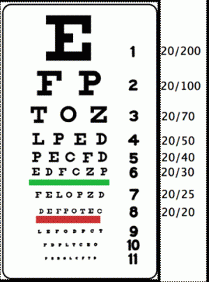 acuitatea vizuală 5 este cum se reduce pierderea vederii